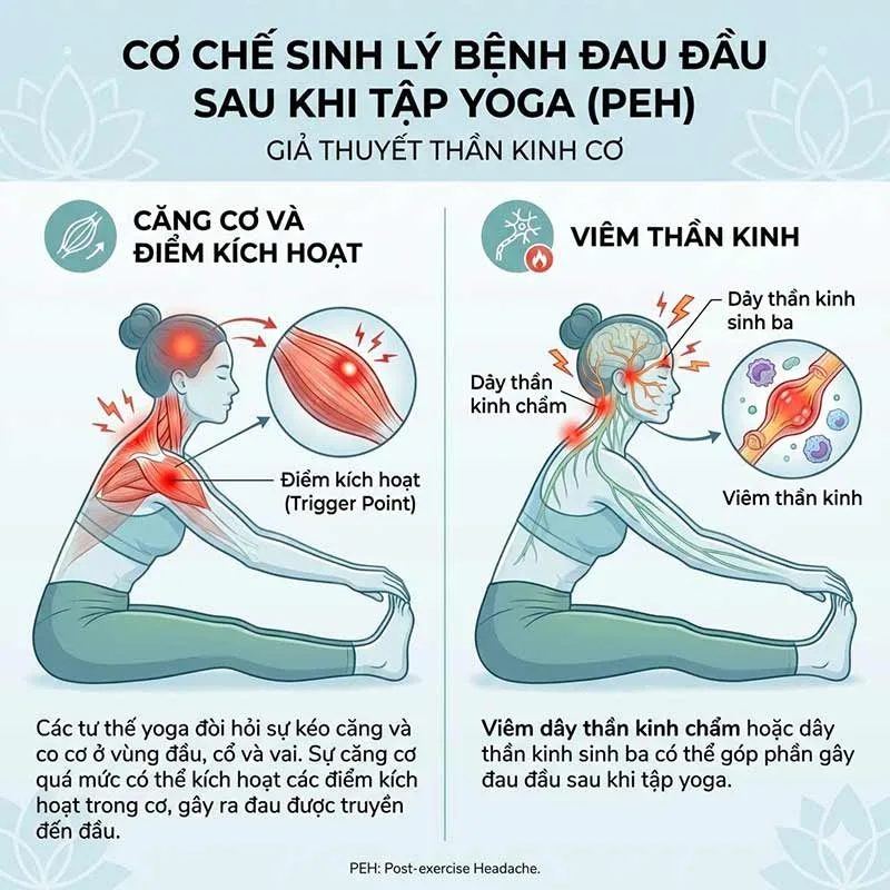 việc kích hoạt cơ bắp quá mức cũng là nguyên nhân gây đau đầu sau khi tập yoga