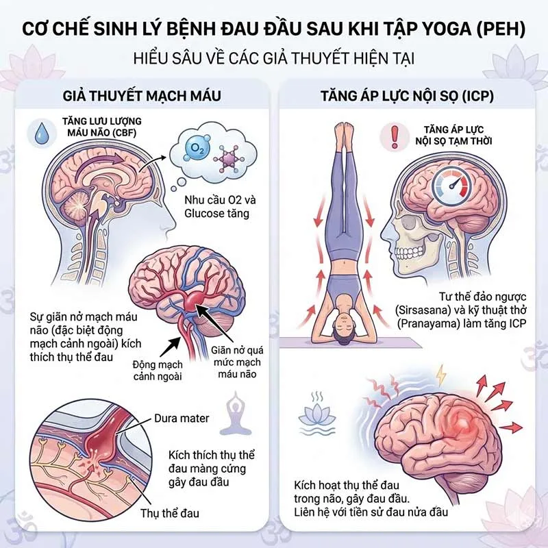 Cơ chế sinh lý bệnh đau đầu sau khi tập Yoga