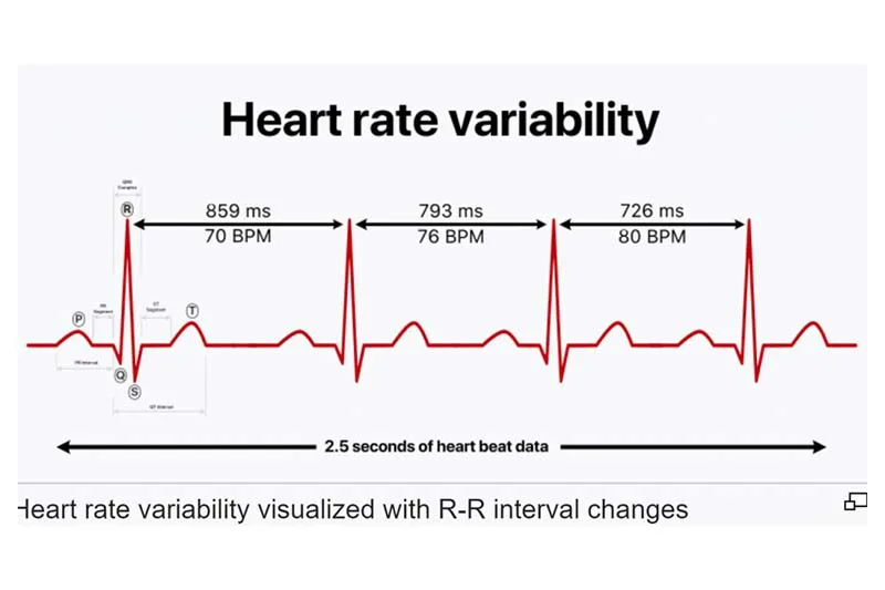 HRV