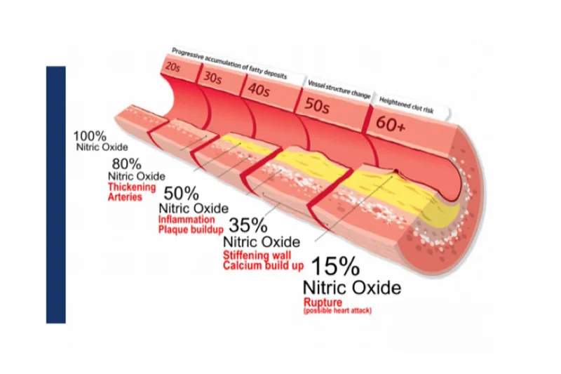 Nitric Oxide